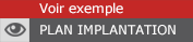 plan implantation